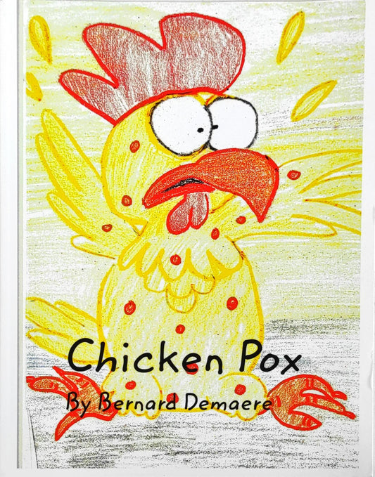 Chicken Pox