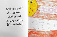 Chicken Pox